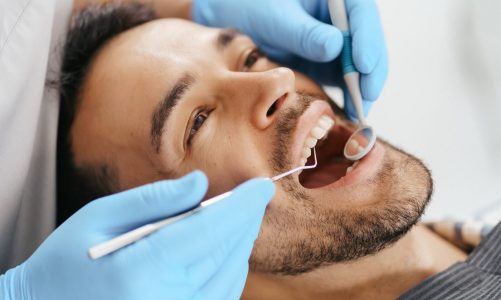 Zabieg wybielania zębów u stomatologa